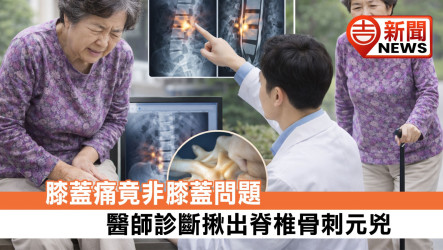 膝蓋痛竟非膝蓋問題 醫師診斷揪出脊椎骨刺元兇