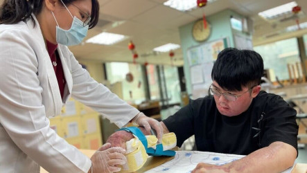 青年力爭26歲當主管卻遇爆炸 基金會助重建人生