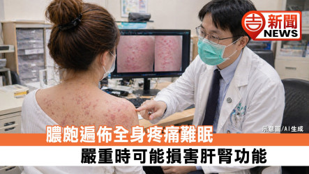 膿皰遍佈全身疼痛難眠 嚴重時可能損害肝腎功能