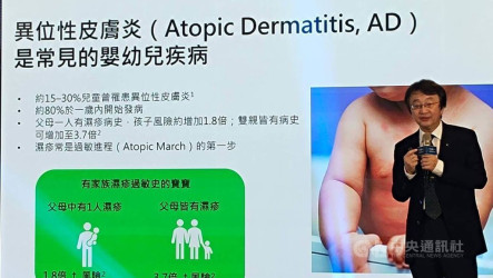 醫師：1歲前罹患濕疹  日後食物過敏、氣喘風險高