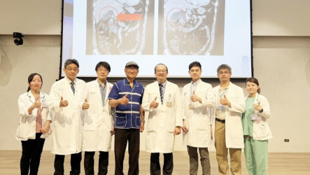 餐後腹脹畏寒膽結石釀急性發炎　醫示警恐引發敗血症