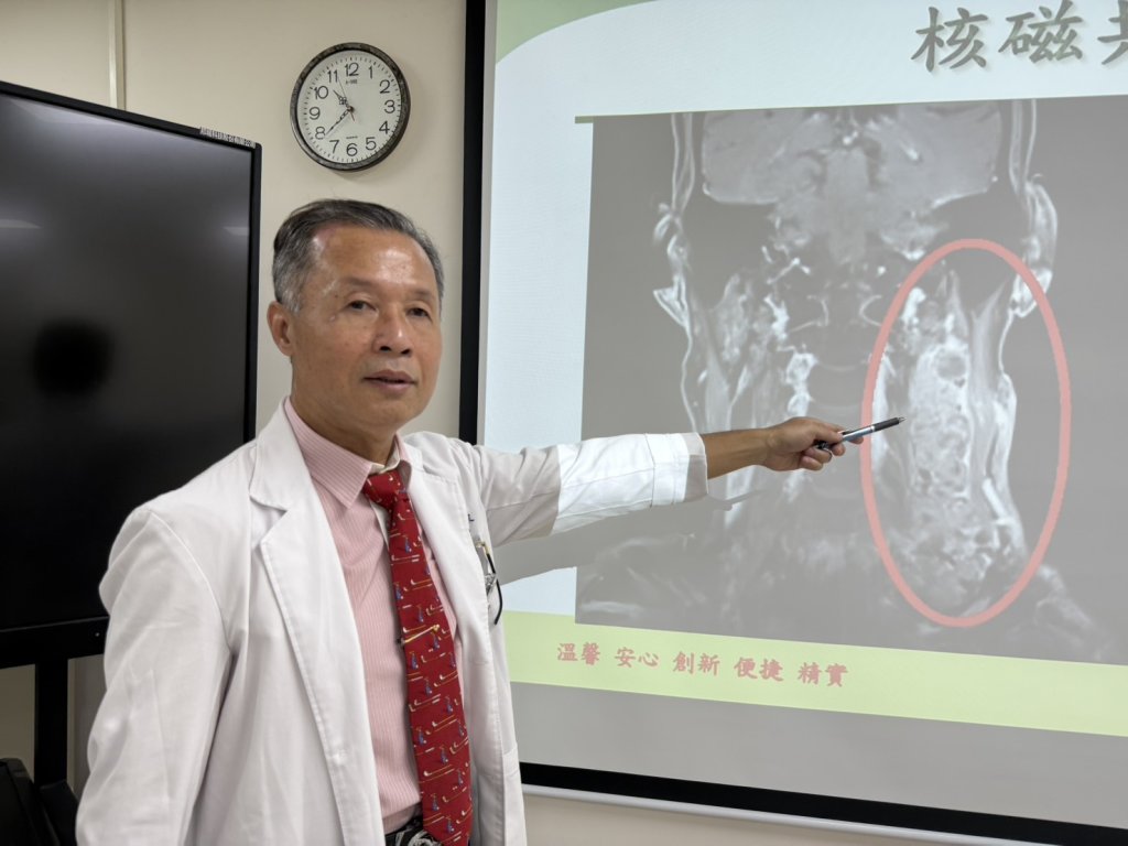 養生企業主喉嚨外觀微凸就醫  竟發現頸部巨大腫瘤